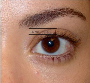 Charlotte Beautiful Eye Charlotte Beautiful Eye