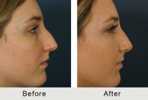 Carolina Surgical Nose Treatment Specialist