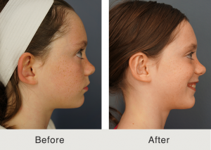 Otoplasty specialist 5 Otoplasty specialist 5