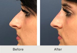 KulbershBeforeAfter5_2