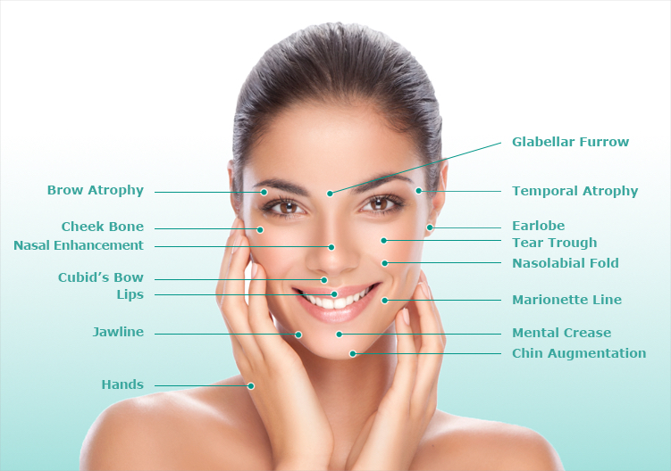 Injectable fillers diagram in Charlotte, NC