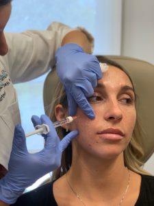 liquid facelift injections in charlotte, nc