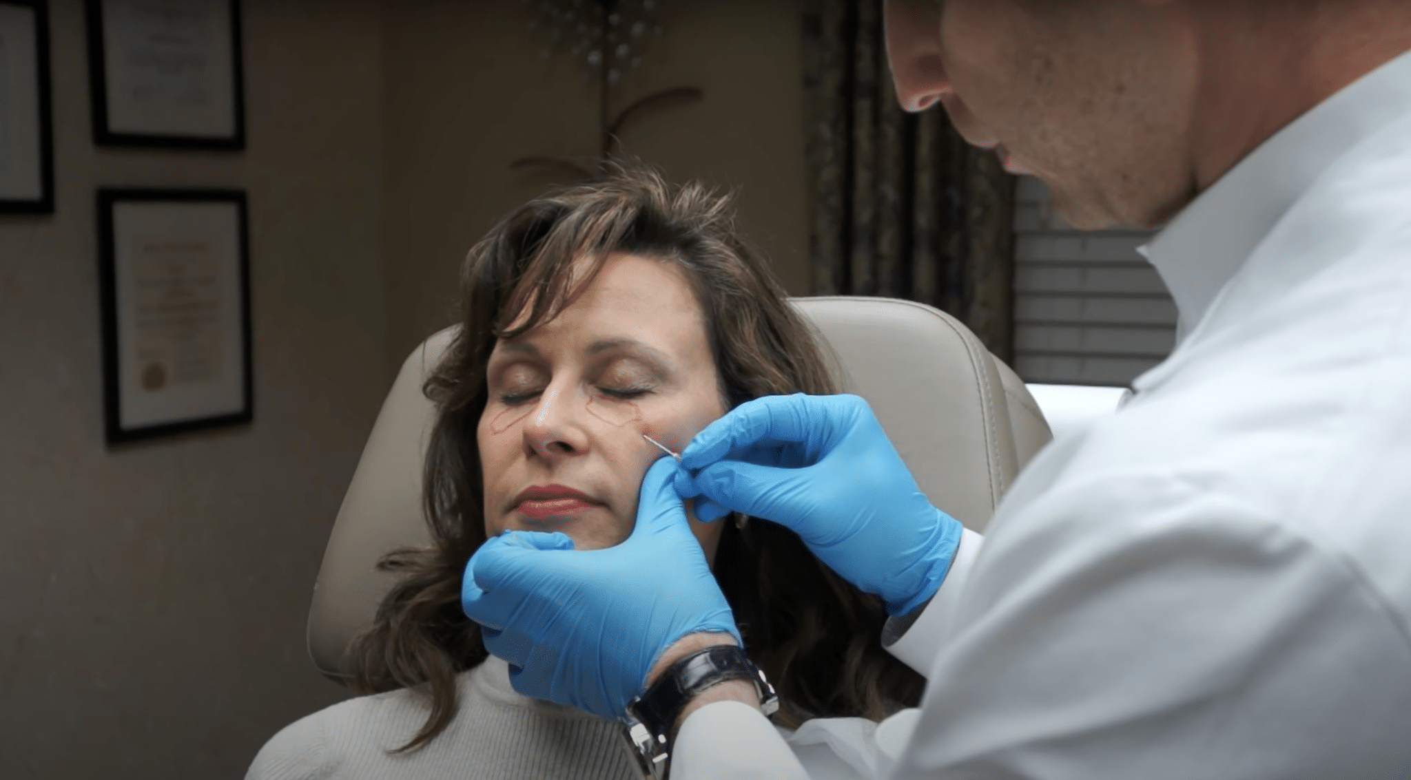 Doctor providing filler dissolution to a patient with hylenex in charlotte