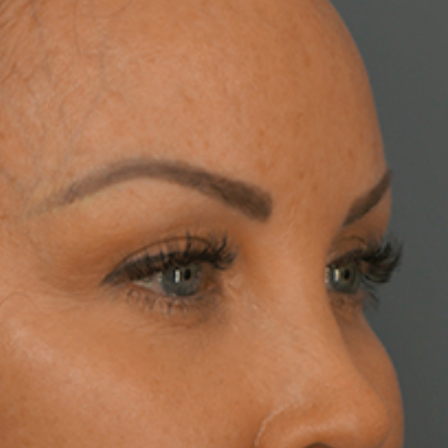 Close-up image of a person's face, showing their eyes, eyebrows, and part of their forehead and nose. The skin appears smooth and is slightly tan with some freckles on the forehead. The eyebrows are dark and well-defined, and the person has long eyelashes. The background is a neutral gray color.