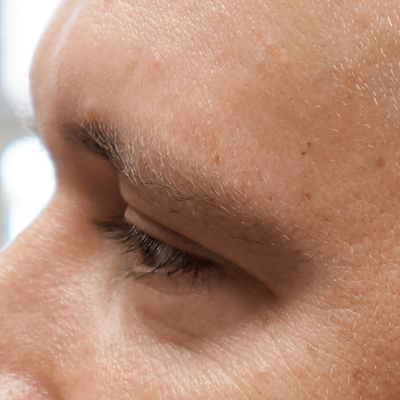 A close-up image of the side profile of a person's face, focusing on the eye and eyebrow area. The skin texture, eyelashes, and short eyebrow hairs are visible. The background is out of focus.