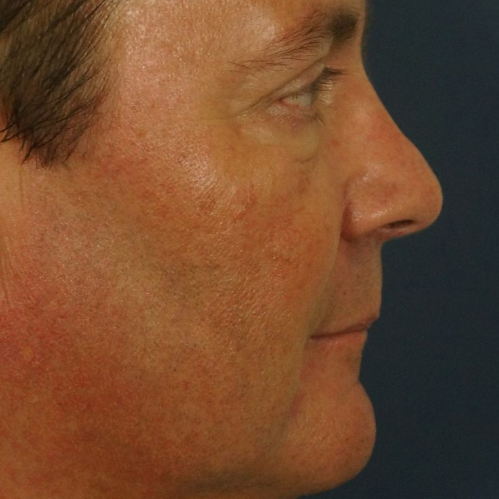 Profile view of a man's face against a dark background.