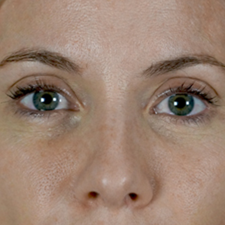 A close-up image of a person's eyes and upper part of the nose. The skin has visible pores and freckles. The eyes are green, and the person has lightly arched eyebrows. The lighting is neutral, highlighting the natural skin texture.