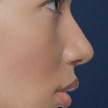 A close-up side profile of a person's face against a dark background, showcasing smooth skin and well-defined features. The focus is on the eye, nose, and lips.
