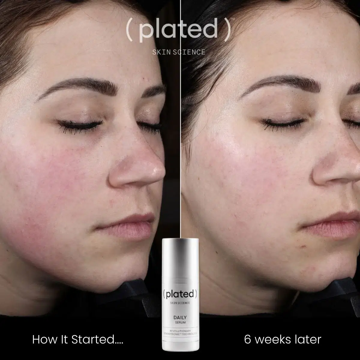 Plated Daily Serum before and after photos of a female