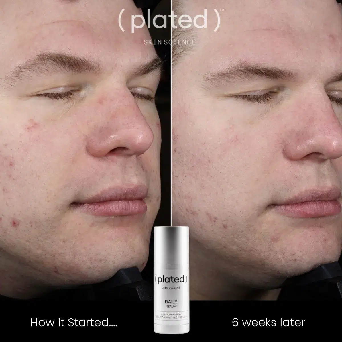 Plated Daily Serum before and after photos