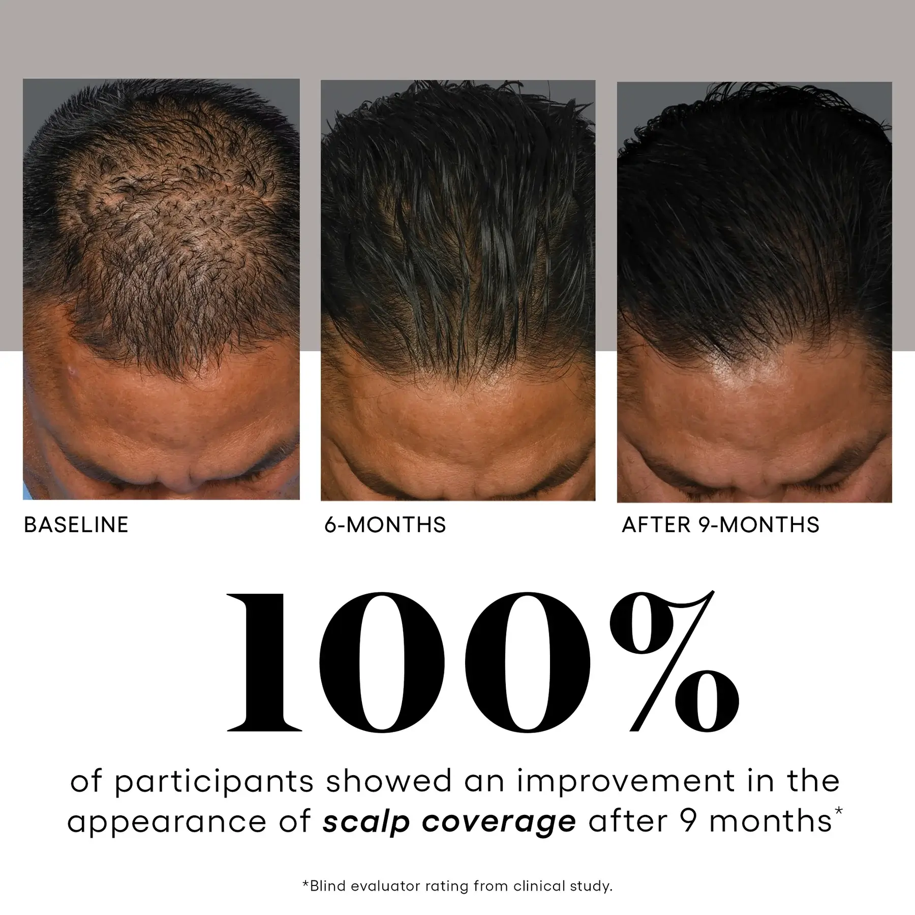 Plated Hair Serum Before and after results