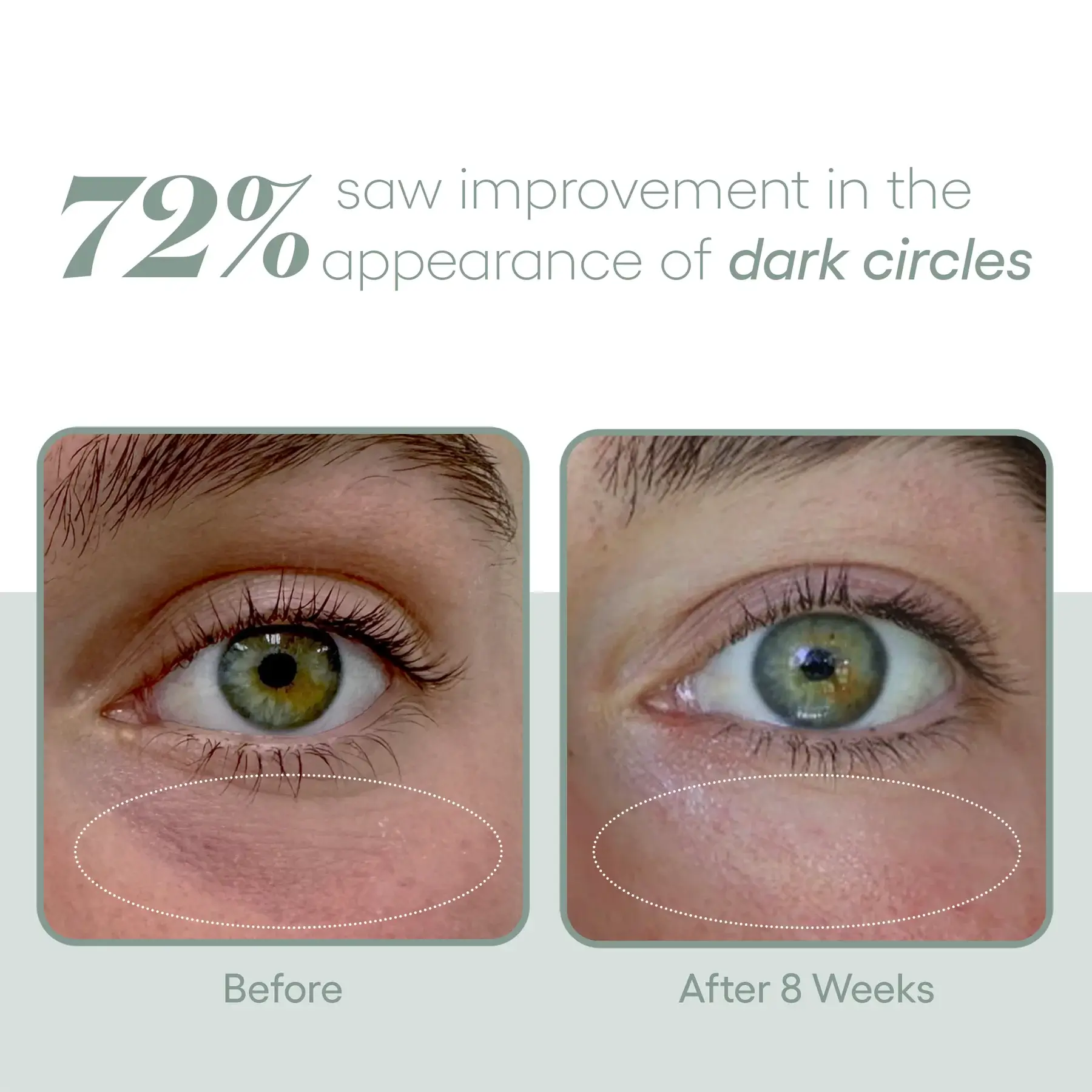 Exosome EYE Serum before and after photos