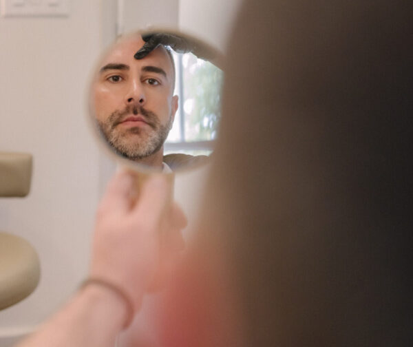 patient looking in the mirror facial fat transfer results 